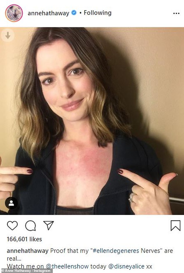 In Red: She's had a stress rash on talk shows before, revealing some of it on her chest again in May of 2016, while promoting Alice Through the Looking Glass on The Ellen DeGeneres Show